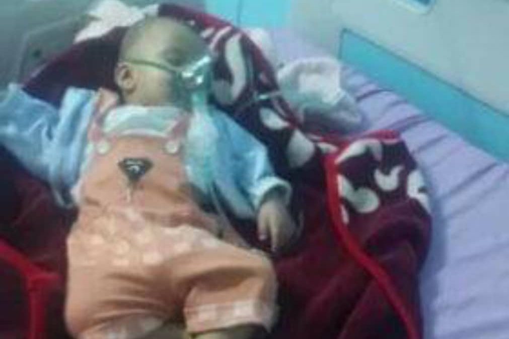 تدهور الحالة الصحية للطفل إدريس ضحية الإهمال الطبي في إب