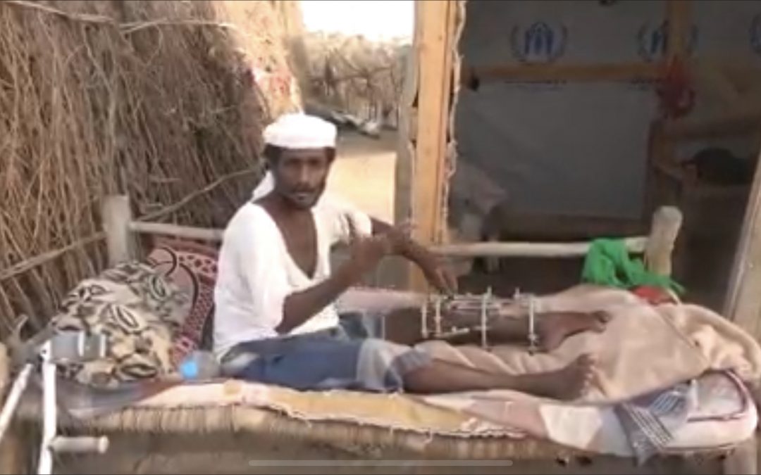 أب معاق وأسرة نازحة.. نتيجة انتهاكات جماعة الحوثي المستمرة بالحديدة