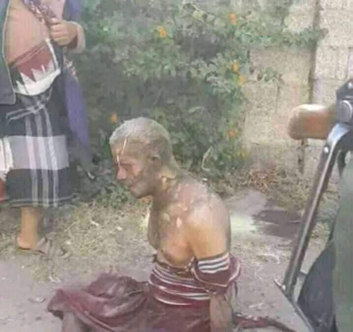 مواطن يحرق نفسه أمام محكمة شرق إب احتجاجاً على حبس نجله ظلماً من قبل جماعة الحوثي